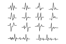 The svg animate element provides a way to animate an attribute of an element over time. Ecg Sinusoidal Pulse Lines Frequency Heartbeat Stress Test 922956 Illustrations Design Bundles