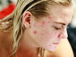 La prima mossa è detergere la pelle del viso. Pulire La Pelle Del Viso Tutti I Metodi Scopri Come Fare Qua