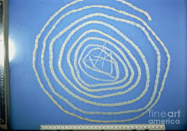 Image result for Beef Tapeworm