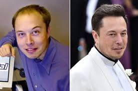 What happened to Elon Musk's hair?