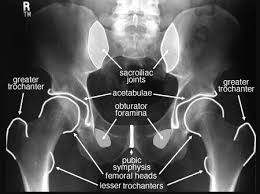 Pelvic xray anatomy to download pelvic xray anatomy just right click and save image as. Pelvis X Ray Anatomy