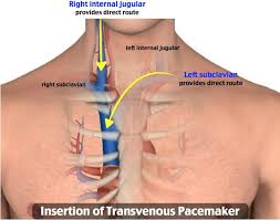 Pin On Cardiology