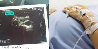 Banyak kali 'cyst' dan 'tumour' pada kilang ovary dijumpai secara kebetulan, ketika wanita berkenaan sedang menjalani pemeriksaan untuk tujuan lain. Tanda Tanda Cyst Ovari Jika Ada Tanda Ini Segera Jumpa Doktor Theasianparent Malaysia