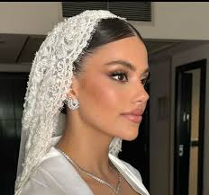 Does anyone here suffer from hair loss? Im panicking over finding a topper  in time for my wedding (so it looks nice and the veil can hold onto  something), and was wondering
