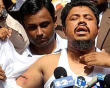 British tourist has leg severed as New York taxi mounts pavement