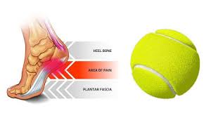 Pin On Exercise