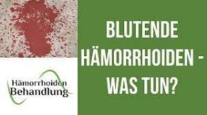 Blutende Hamorrhoiden Was Kann Man Tun Wenn Die Hamorrhoiden Bluten Youtube