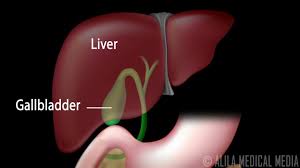 Ultrasound (in most cases, it is the only test the doctor orders to detect the problem) Gallstones And Surgical Removal Of Gallbladder Cholecystectomy Animation Youtube