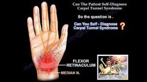 Image result for Carpal Compression Test