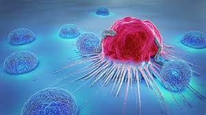 We can also group cancer according to the type of cell they start in. Cancer Cells Versus Normal Cells Lippincott Nursingcenter