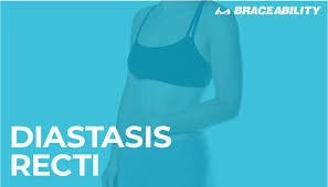 Maybe you would like to learn more about one of these? A Complete Guide To Diastasis Recti Truths On Abdominal Separation