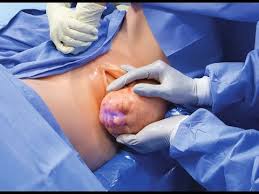 Image result for giving birth crowning pictures