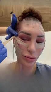 Charlie Sheen's daughter Sami posts shocking before-and-after photos  revealing all her plastic surgeries (link in the comments)