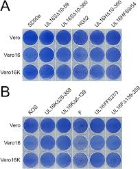Unlike rgb and cmyk, which use primary colors, hsv is closer to how humans perceive color. Comparative Analysis Of Ul16 Mutants Derived From Multiple Strains Of Hsv 2 And Hsv 1 Reveals Species Specific Requirements For The Ul16 Protein Biorxiv