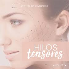Hilos tensores:
