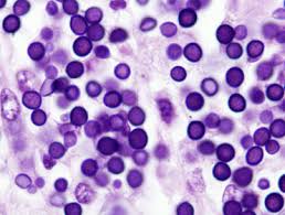 Image result for Lankesteria