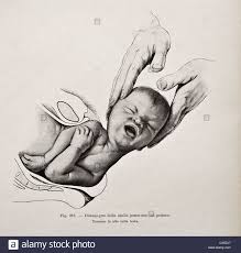 Download This Stock Image Illustration Of Human Birth Copyright 1905 C4d2j7 From Alamy S Library Of Millions Medical Drawings Birth Art Medical Illustration