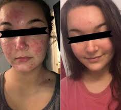 Pomifera by Mandy Bowen (@mbshairwithstyle_pomifera) • Instagram photos and  videos