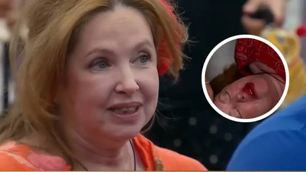Andrea del Boca reapareció tras su accidente en Gran Hermano y mostró cómo  quedó su rostro - VOXPOPULI TU VOZ ES NOTICIA