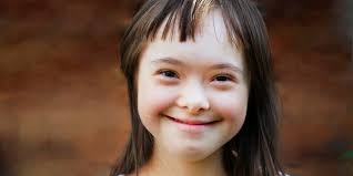 Chi Sono I Bambini Down Accademia Del Cuore