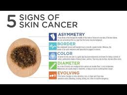 Major signs that indicate bone cancer in foot and ankle. Top 5 Signs Of Skin Cancer Infographic Youtube