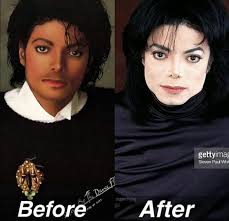 How Come Nobody Ever Apologizes to Michael Jackson: The Man in the Mirror  (Addressing the Plastic Surgery Misconceptions)