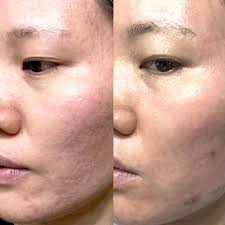 Jose Bodon-Orsini (@jbodonorsini__) • Instagram photos and videos