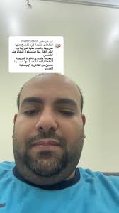 الرد على الدفعات المقدمة وفواتيرها