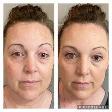 Model for holiday collection campaign