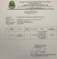Hasil Tes Covid 19 Bupati Cellica Negatif Disambut Rasa Syukur Warga Karawang Bekasi Online