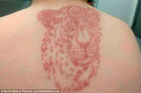 Holiday henna tattoos colour risk warns nhf hji. Mother S Warning After Black Henna Tattoos Her Two Sons Got On Holiday Cause Severe Chemical Burns Express Digest