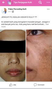 Pakar Perunding Kulit