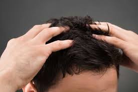 Untuk vitamin rambut yang kami sarankan untuk anda sebaiknya memiliki bahan alami seperti dari gingseng, kemiri, aloe vera, urang aring dan lain sebagainya. 6 Vitamin Rambut Rontok Dan Kering Terbaik Untuk Pria