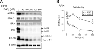 What will set off a metal detector? Response To Iron Overload In Cultured Hepatocytes Scientific Reports