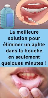 Pin On Remedes Maison