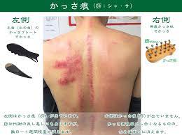 図解と動画 かっさの方法と効果的なかっさプレートの使い方 台湾美容技芸発展協会 かっさ 美容 スキンケア