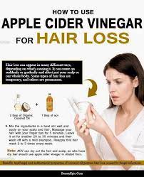 Apple cider vinegar and baking soda for hair loss baking soda along with acv removes toxins from your hair and fosters hair growth and prevents hair loss. Apple Cider Vinegar For Hair Loss Benefits And How To Use Vinegar For Hair Apple Cider Vinegar For Hair Natural Hair Loss
