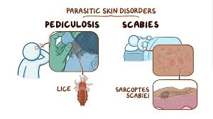 Image result for scabies transmission
