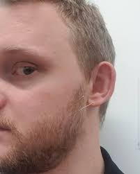 Spine Consultants (@spine_consultants) • Instagram photos and videos