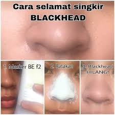 10 cara terbaik untuk menghilangkan komedo di hidung dari rumah. Cara Selamat Menghilangkan Blackheads Yatie Marykay Ibc Facebook