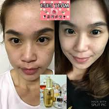 Adenosine provides wrinkle diminishing effect to aging skin with lost resilience and niacinamide powerful nourishment royal jelly propolis, the natural penicillin green tea extract, asiatic pennywort extract licorice extract, chamomile, korean. Eses Pearl Cream From Korea çç è† 15g æŠ¤è‚¤ç¾Žè‚Œ æŠ¤è‚¤ä¿å…» æ¬¢è¿Žå…‰ä¸´pretty Princess Onlineshop é©¬æ¥è¥¿äºšçŽ°è´§è´­ç‰©ç½' æ¯å¤©24å°æ—¶æŽ¥ç•™è¨€ è®¢å• Powered By 1maxhostingenterprise