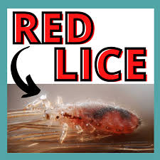 Image result for Lice