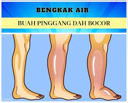 Buah pinggang berfungsi sebagai penapis darah dan membuang toksik dari badan melalui proses perkumuhan yang berlaku melalui saluran kencing anda. Stor Kesihatan 3 Petanda Utama Fungsi Buah Pinggang Facebook