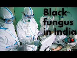 There are many black fungus symptoms, such as toothache. Covid 19 Beware Of Black Fungus