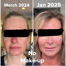 💎𝚂𝙴𝙸𝙽𝚃 𝐌𝐚𝐭𝐮𝐫𝐞-𝐒𝐤𝐢𝐧 𝙼𝙰𝙺𝙴𝚄𝙿 and Riman Skincare By  Jewel💎