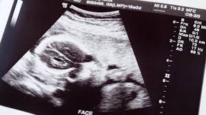 My Slightly Unreal Pandemic Pregnancy The New Yorker
