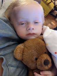 Finley continues to change daily. His little body is beginning to let go.  He went 14 hours without peeing today. He finally peed 15 minutes ago. He  has a fever tonight but