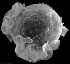 Mononucleosis (commonly known as mono or the kissing disease) is an illness that may be more. Epstein Barr Virus Microbewiki