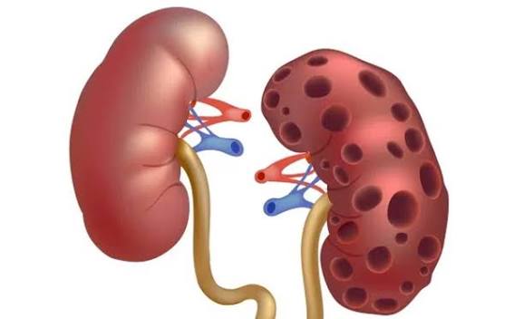 Nhận biết nguyên nhân, triệu chứng của thận yếu, thận hư và cách phòng  ngừa, điều trị