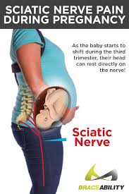 Sciatica during pregnancy ranges from mild to severe and it feels like different things to different women. Pin On Back Pain Relief Exercises Stretches Yoga To Treat Back Problems